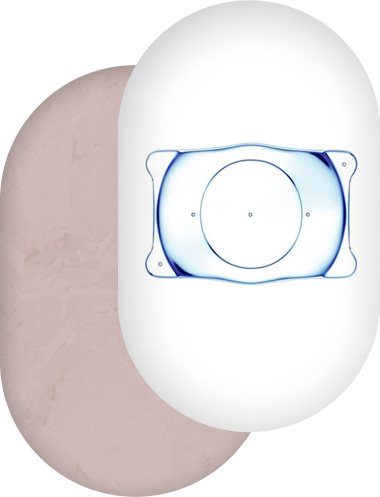 眼科専門医によるICL( 眼内コンタクトレンズ )