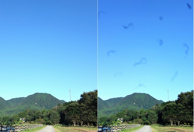 飛蚊症（ひぶんしょう）とは