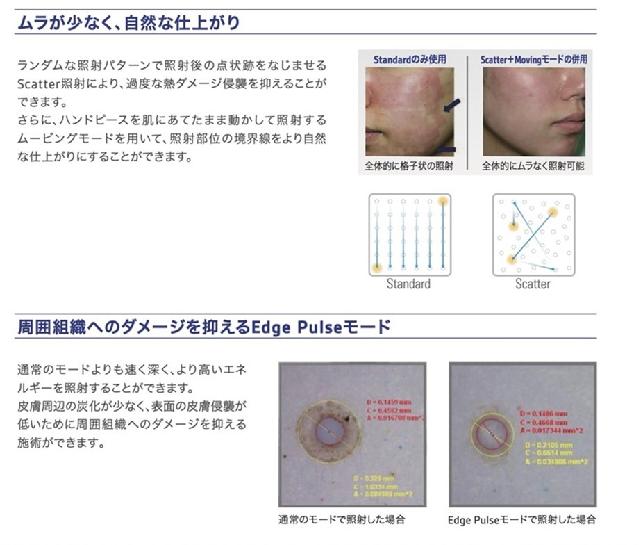 エッジワンの説明