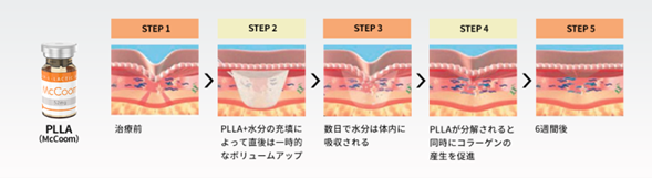 マックームの期待できる効果