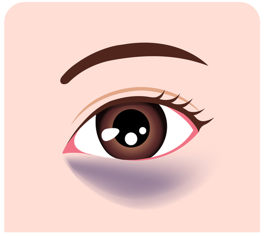 紫クマ（青クマ・赤クマ）